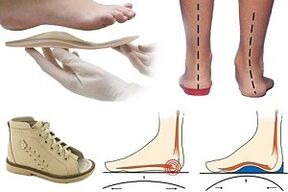 pantofi ortopedici pentru hallux valgus la un copil