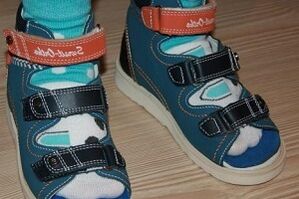purtarea de sandale pentru hallux valgus la un copil