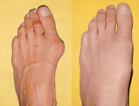 Simptome
